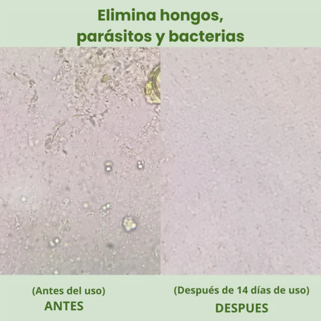 Vitalora OregaMix – Aceite de Orégano Potenciado